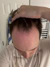 Need help deciding what to do about my hair