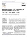 Atypical Fibroxanthoma of the Scalp Following Hair Transplantation in a 35-Year-Old Male