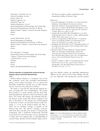 Clinical Evaluation of Postoperative Pressure-Induced Alopecia Using a Hand-Held Dermatoscope