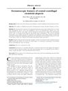 Dermatoscopic Features of Central Centrifugal Cicatricial Alopecia