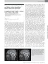Treatment-Resistant Schizophrenia and Global Cortical Atrophy in a Patient with Turner Syndrome