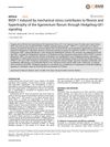 WISP-1 Induced by Mechanical Stress Contributes to Fibrosis and Hypertrophy of the Ligamentum Flavum Through Hedgehog-Gli1 Signaling