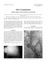 Pustular Allergic Contact Dermatitis from Minoxidil