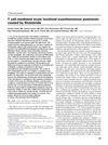 T Cell–Mediated Acute Localized Exanthematous Pustulosis Caused by Finasteride