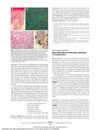 Minoxidil-Induced Trichostasis Spinulosa of Terminal Hair