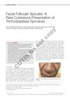 Facial Follicular Spicules: A Rare Cutaneous Presentation of Trichodysplasia Spinulosa