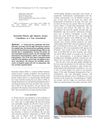 Kawasaki Disease and Alopecia Areata: Coincidence or True Association?