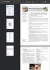 A Case of Stress-Induced Alopecia Areata Treated by Homeopathic Medicine: An Individualistic Approach