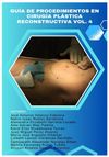 Guide to Procedures in Reconstructive Plastic Surgery Vol. 4