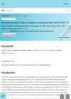 Not Just Thinning: A Case of Alopecia Universalis After Mild COVID-19