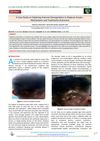 A Case Study on Exploring Immune Dysregulation in Alopecia Areata: Mechanisms and Treatment Outcomes
