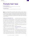 Female Hair Loss: Assessment, Categorization, and Management