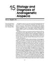Etiology and Diagnosis of Androgenetic Alopecia