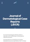 Dermoscopy Findings of Alopecia Areata in an African-American Patient