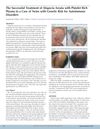 The Successful Treatment of Alopecia Areata with Platelet-Rich Plasma in Twins with Genetic Risk for Autoimmune Disorders