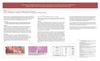 A Case Report of Granuloma Faciale of the Scalp Arising in the Setting of Advanced Androgenetic Alopecia With a Review of Extrafacial Granuloma Faciale Occurring on the Scalp