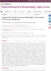 Atypical Presentation of Lichen Planopilaris: Presentation of Two Cases and Review