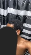 My hair receding/thinning 20m what’s should I do?