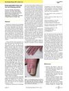 Excess Granulation Tissue and Hair Loss Following Acitretin