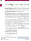 Finasteride in Early Male Baldness