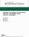 Qualitative Investigation of Fresh Human Scalp Hair with Full-Field Optical Coherence Tomography