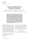 Cutaneous Manifestations of Mucopolysaccharidoses
