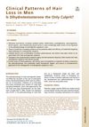 Clinical Patterns of Hair Loss in Men