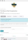 The History of Hair Transplantation