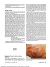 Psoriatic Alopecia: Clarification and Critique