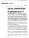 Nestin as a Marker of Unipotent Embryonic and Adult Progenitors Differentiating into an Epithelial Cell Lineage of the Hair Follicles