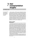 Hair Transplantation Surgery