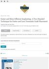 Easier and More Efficient Implanting: A Two-Handed Technique for Faster and Less Traumatic Graft Placement