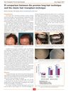 A Comparison Between the Preview Long Hair Technique and the Classic Hair Transplant Technique