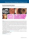 New-Onset Gastrointestinal Polyposis in a 60-Year-Old Man with Cronkhite-Canada Syndrome