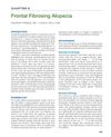 Frontal Fibrosing Alopecia: Clinical Features, Diagnosis, and Treatment Challenges
