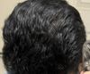 18M 4 months on fin. Is my medication working?