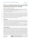 A Case of Vitiligo Combined With Systemic Lupus Erythematosus Treated With Tofacitinib