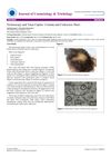 Trichoscopy and Tinea Capitis: Comma and Corkscrew Hairs