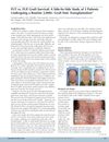 FUT vs. FUE Graft Survival: A Side-by-Side Study of 3 Patients Undergoing a Routine 2,000+ Graft Hair Transplantation