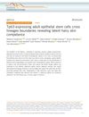 Tp63-Expressing Adult Epithelial Stem Cells Cross Lineage Boundaries Revealing Latent Hairy Skin Competence