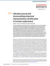 Ultrastructural and Immunohistochemical Characteristics of Telocytes in Human Scalp Tissue
