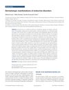 Dermatologic Manifestations of Endocrine Disorders