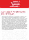 Hair Loss in Patients with Skin of Color