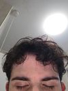 Do i hop on finasteride and minoxidil?