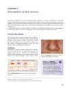 Description of Skin Lesions