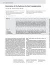 Restoration of the Eyebrows by Hair Transplantation