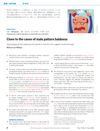 Clues About The Causes Of Male Pattern Baldness