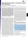 Myocardial NF-κB Activation Is Essential for Zebrafish Heart Regeneration
