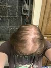 22m. Is it even worth it to try fin at this stage?