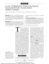 A Case of Inflammatory Nonscarring Alopecia Associated With the Tyrosine Kinase Inhibitor Nilotinib